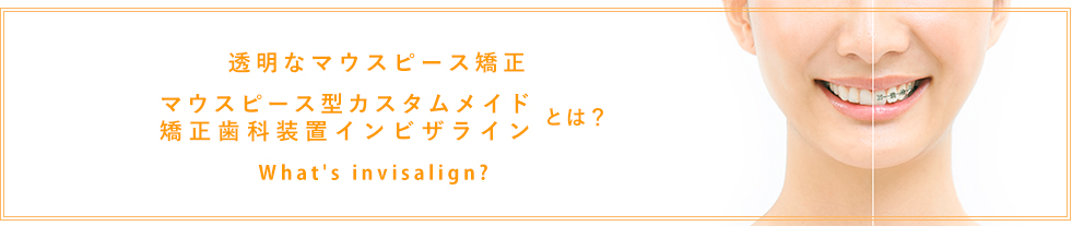 透明なマウスピース矯正「インビザライン」とは？